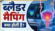 What Is Bladder Mapping