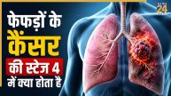 Lung Cancer Symptoms Stage 4