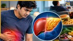 Non Alcoholic Fatty Liver Disease Young Adults