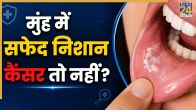 Oral Cancer Signs And Symptoms