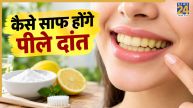 Yellow Teeth Home Remedies