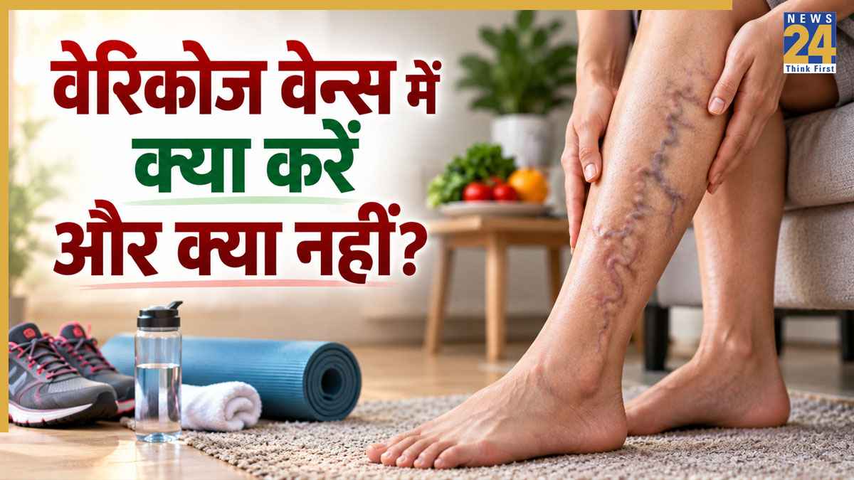 पैरों पर नीली-हरी धारियां वेरिकोज वेन्स का हो सकती हैं लक्षण, कभी ना करें ये 3 काम नहीं तो बढ़ जाएगी दिक्कत
