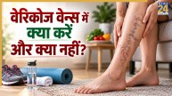 Varicose Veins Treatment