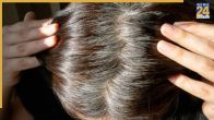 White Hair In Young Age