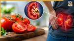 Kidney Stones Causes