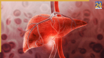 these food should avoid in liver health