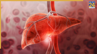 these food should avoid in liver health