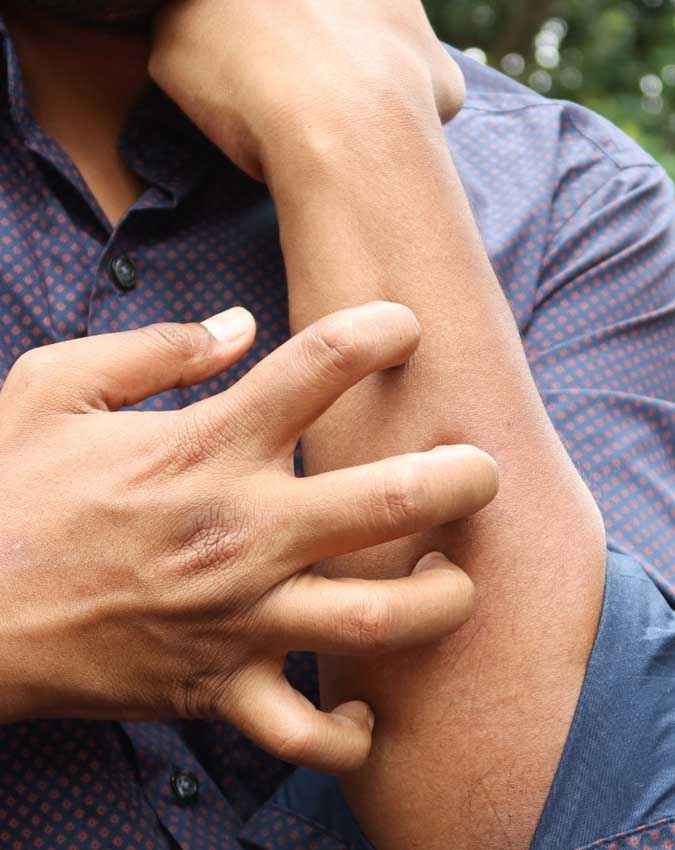 त्वचा पर किडनी की बीमारी के लक्षण 