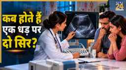 धड़ एक, सिर दो… जानें कब पैदा होते हैं ऐसे बच्चे? क्या कहती है रिसर्च