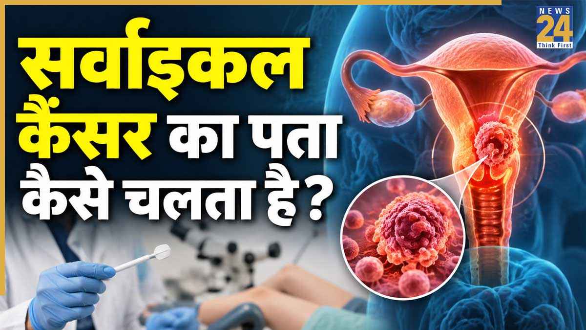 Cervical Cancer