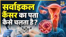 सर्वाइकल कैंसर की जांच कब और कैसे करानी चाहिए? डॉक्टर ने बताया टेस्ट का नाम