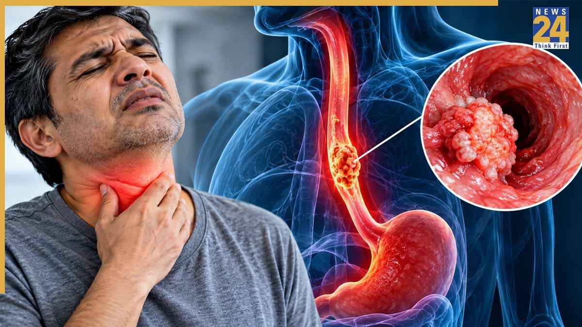 Esophageal Cancer: खान-पान से जुड़ी यह एक गलती बन सकती है भोजन नली के कैंसर की वजह, यहां जानिए कारण और लक्षण