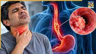 Esophageal Cancer: खान-पान से जुड़ी यह एक गलती बन सकती है भोजन नली के कैंसर की वजह, यहां जानिए कारण और लक्षण