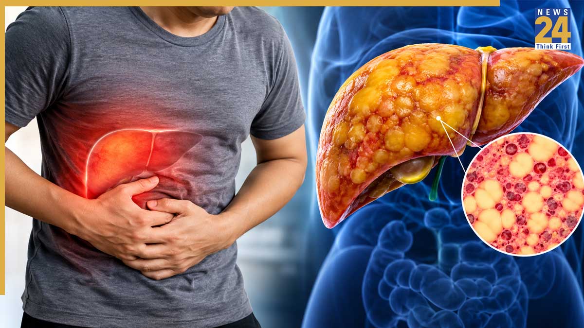 Fatty Liver Problem: लोगों के बीच तेजी से बढ़ रही है फैटी लिवर की समस्या, जिए क्या खाएं, क्या छोड़ें?