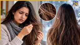 सर्दियां शुरू होते ही बाल हो जाते हैं बेजान और रूखे? अपनाएं ये टिप्स