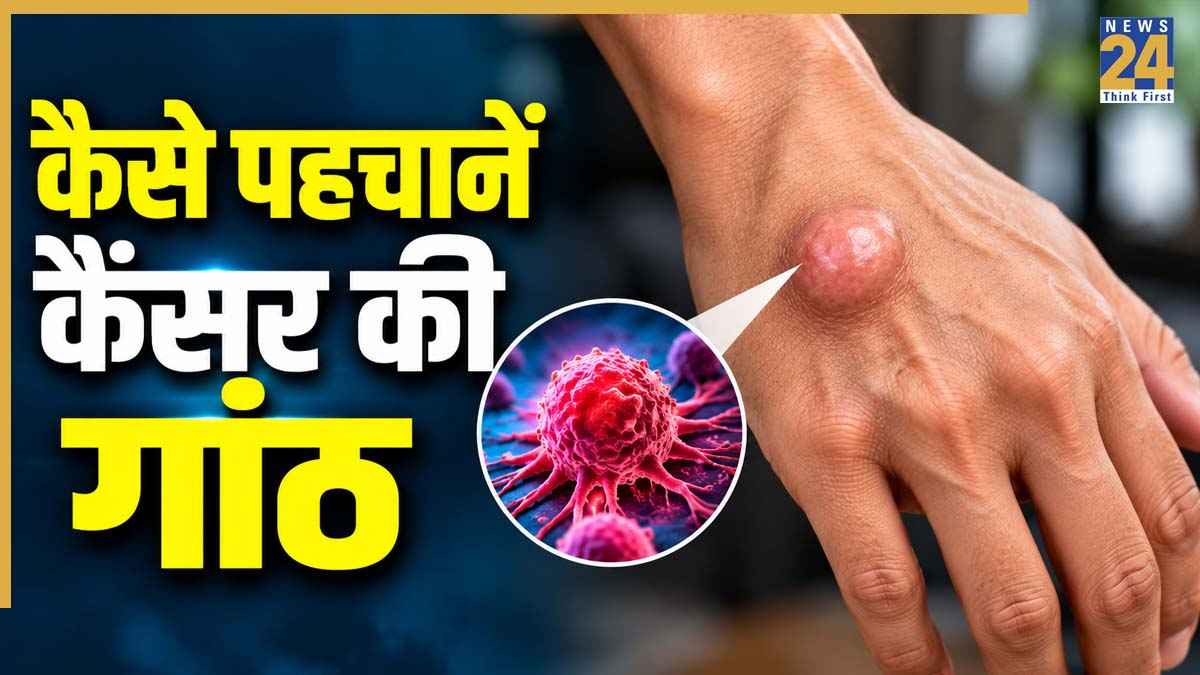 Cancer Lump