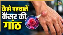 हाथ-पैर पर दिखने वाली गांठ कैंसर की है या नहीं कैसे पता चलेगा