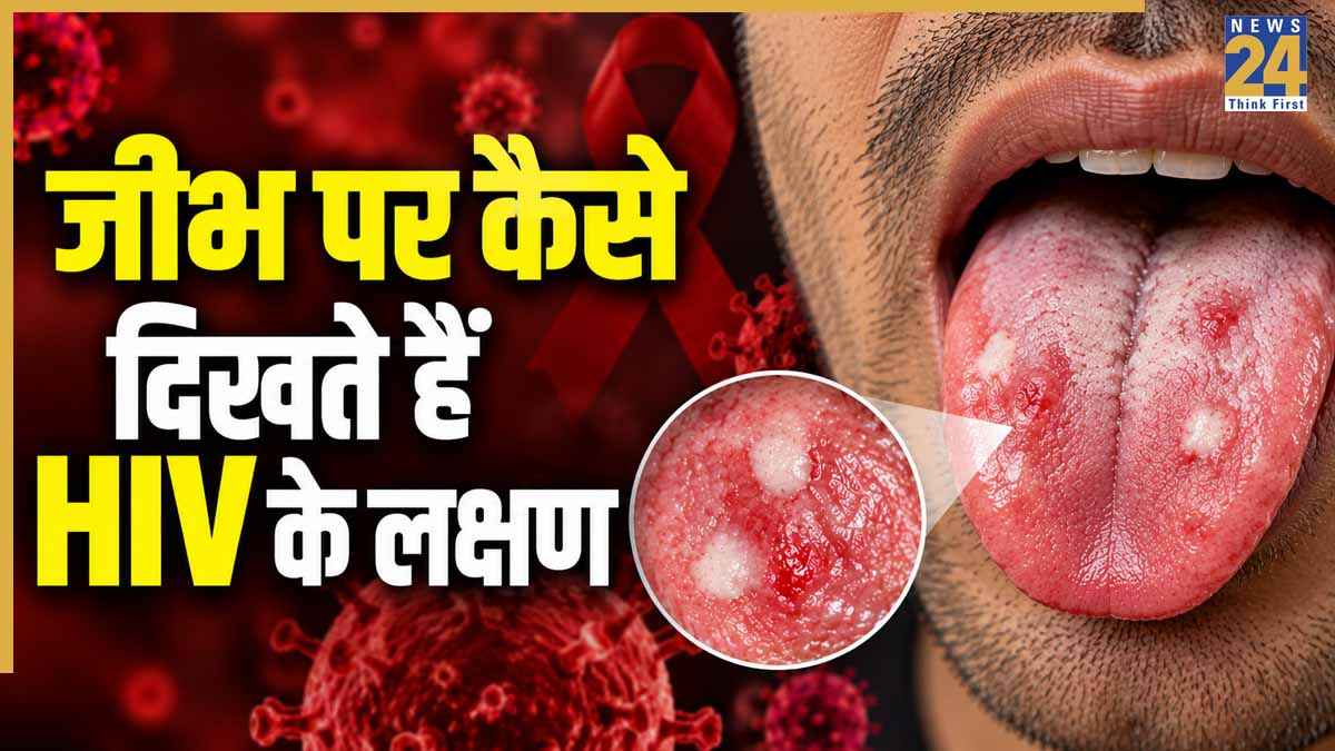 HIV Symptoms In Men