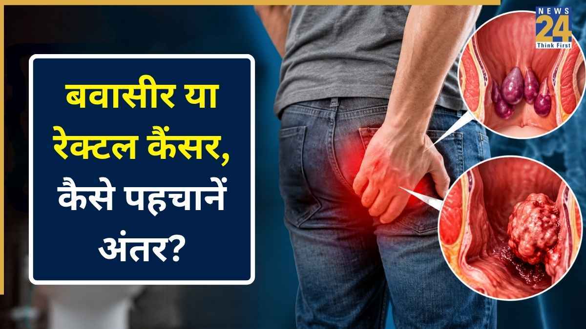 कहीं बवासीर समझकर कैंसर को तो नहीं कर रहे नजरअंदाज? डॉक्टर ने बताया