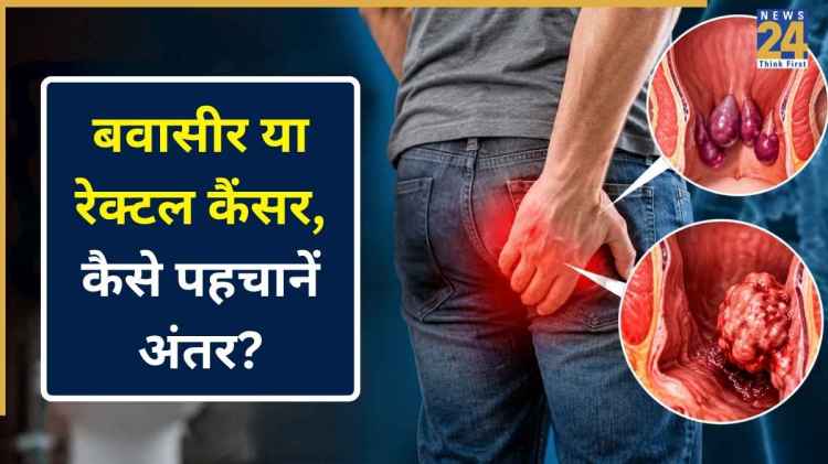 कहीं बवासीर समझकर कैंसर को तो नहीं कर रहे नजरअंदाज? डॉक्टर ने बताया
