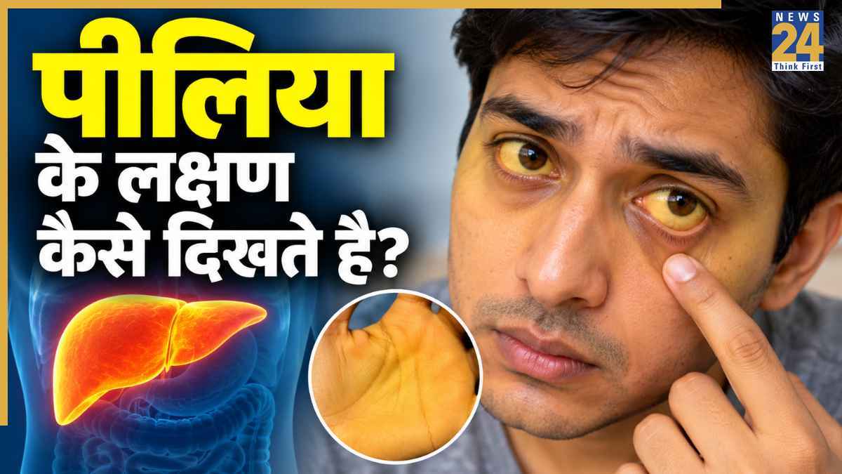 Jaundice Symptoms