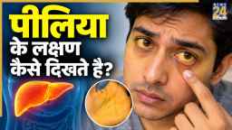 पीलिया होने पर दिख सकते हैं ये 7 लक्षण, स्वास्थ्य मंत्रालय ने बताया