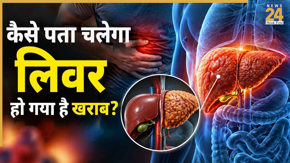 Liver cirrhosis symptoms