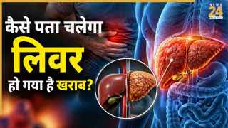 लिवर सिरोसिस के इन 7 लक्षणों को कभी ना करें नजरअंदाज, AIIMS ने दी सलाह