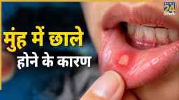 क्या मुंह में छाले होने का कारण कैंसर है? जानें कब हो सकती है बीमारी