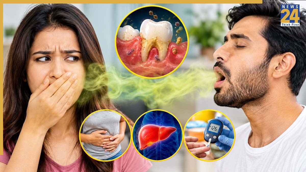 Chronic Halitosis Medical Causes