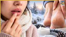 Winter Care Tips: ठंड आने से पहले ही फटने लगे होंठ और एड़ियां? अभी से शुरू कर दें ये काम