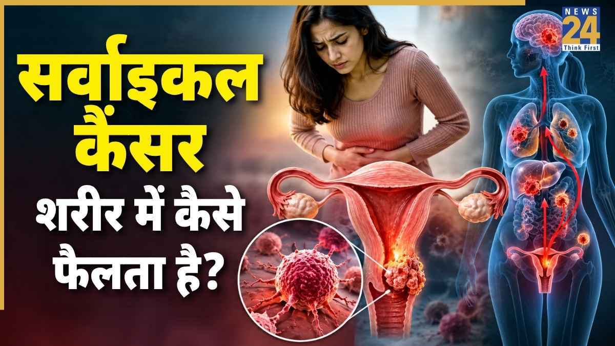 Cervical Cancer